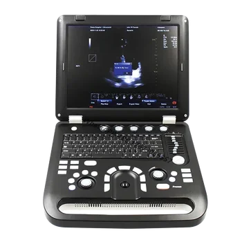 Портативный ультразвуковой доплеровский сканер CONTEC CMS1700C 3D 4D с односторонним дроссельным клапаном